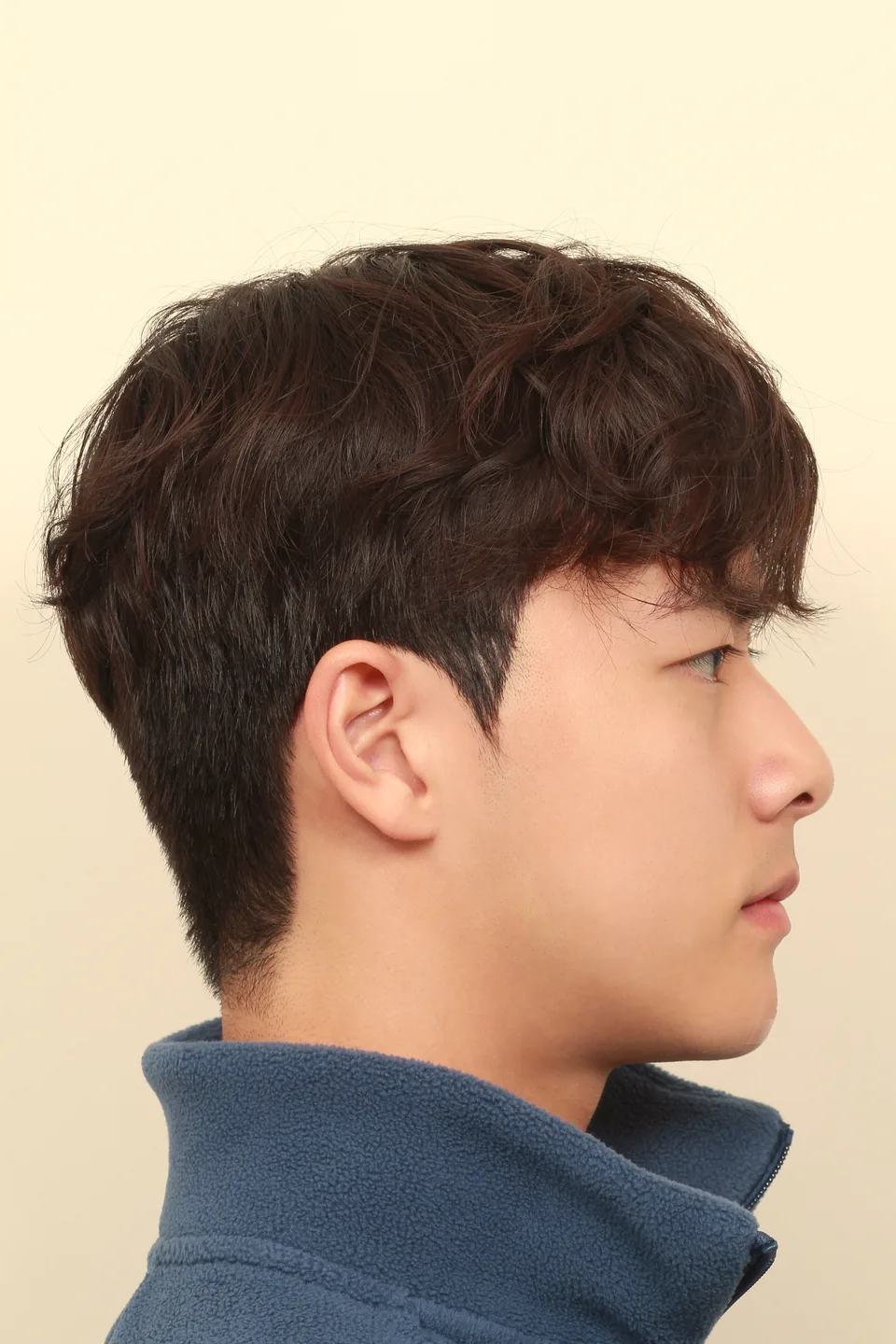 수술 후 6개월 측면