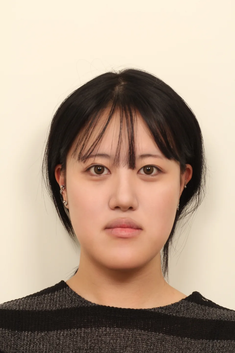 긴 얼굴 수술 전 정면