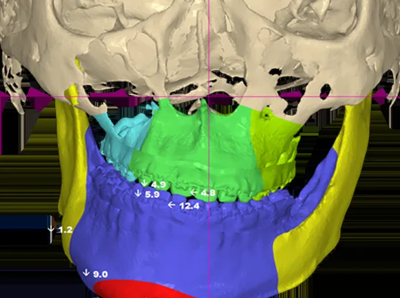 CT·скан·зургийг нэгтгэсэн 3D загвар