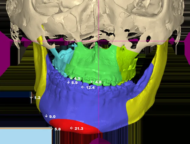 CT·스캔·사진을 합친 3D 모델