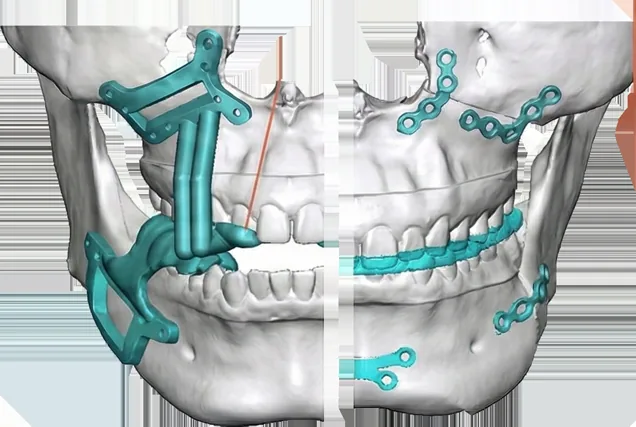 3D 프린팅 모형